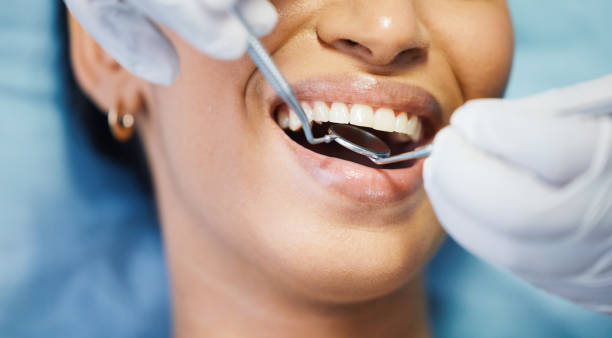 Best Emergency Dentist for Lost Fillings or Crowns in New Fairview, TX